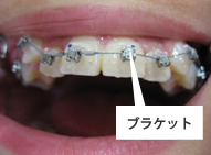 トランスファートレーを取り外したところ