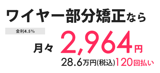 分割払い 月々の金額