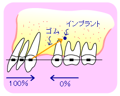 o~jXN[gĈړꍇ