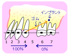 Ԃ̂悭Ȃ𔲂ă~jXN[gAړB