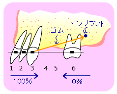 Œ茹ƂȂ鉜ȂꍇLłB