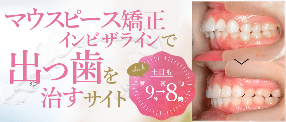 �C���r�U���C���ŏo�����������T�C�g